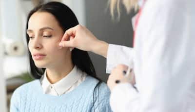 Top Pimple Patches to Grab During Myntra Fashion Carnival (6th - 12th February)