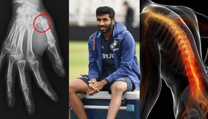 Jasprit Bumrah's Injury Track Record: From Thumb Fracture In 2018 To Back Spasm In 2025 - In Pics
