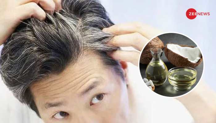 White Hair? Coconut Oil Will Make White Hair Black Naturally, Mix THESE