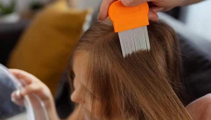 Say Goodbye To Lice: 7 Natural Home Remedies To Remove Lice From Your Child’s Hair