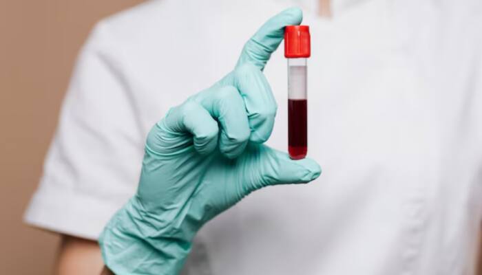 New Blood Test Can Predict Risk Of 30 Age-Related Diseases Decades In Advance