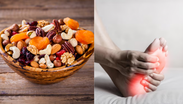 5 Best Dry Fruits To Reduce High Uric Acid Naturally And Improve Joint Health 5 Best Dry Fruits To Reduce High Uric Acid Naturally And Improve Joint Health