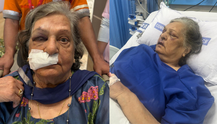82-Year-Old Woman Ends Up In ICU After Air India 'Denies' Wheelchair Assistance At Delhi Airport 82-Year-Old Woman Ends Up In ICU After Air India 'Denies' Wheelchair Assistance At Delhi Airport