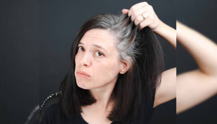 Do's & Don'ts For Preventing Premature Grey Hair: Effective Tips To Keep Youth