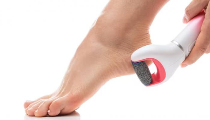 Foot Callus Remover Deals: Smooth Feet for Less