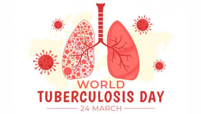 World TB Day 2025: Theme, History, Significance, And India’s Fight Against Tuberculosis