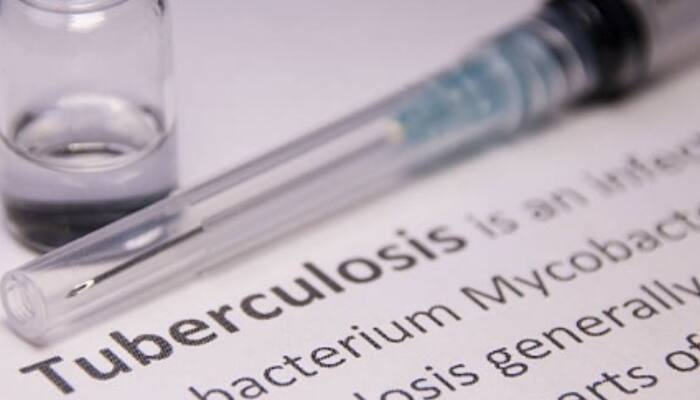 WHO Urges Urgent Action To Eliminate Tuberculosis By 2030 Amid Rising Cases