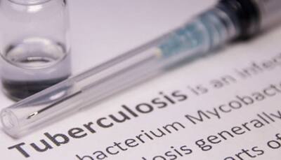 WHO Urges Urgent Action To Eliminate Tuberculosis By 2030 Amid Rising Cases