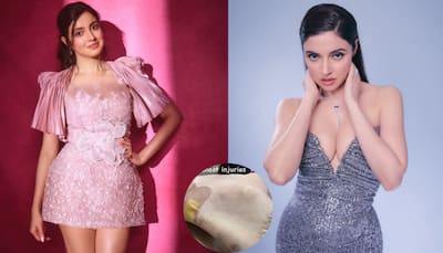 Divya Khossla Suffers Injury On Film Sets, Netizens Wish Her A Speedy Recovery
