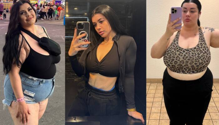 Weight Loss Journey: Woman Lost 62 Kg WITHOUT A Diet Plan, Shares Her Secret Rule
