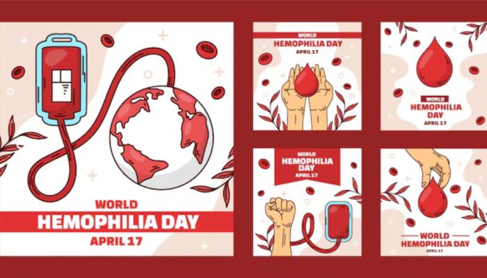 World Hemophilia Day 2025: Theme, History, Significance, And How It Is Observed Globally