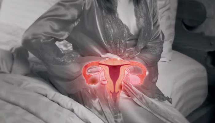 The Unseen Pain: Exploring The Link Between Endometriosis And Mental Health The Unseen Pain: Exploring The Link Between Endometriosis And Mental Health