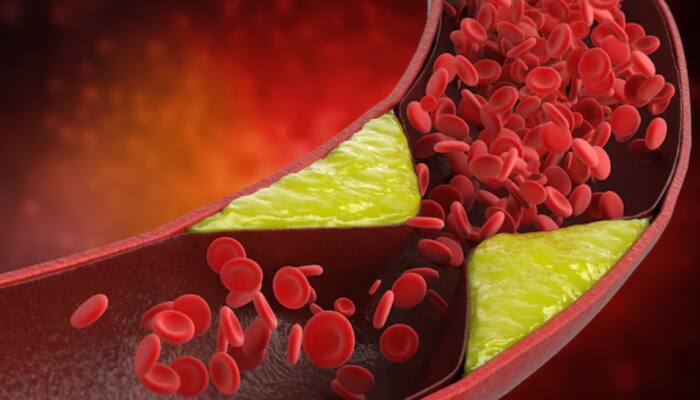Indian Scientists Develop Eco-Friendly Silk-Based Optical Sensor For Early Cholesterol Detection