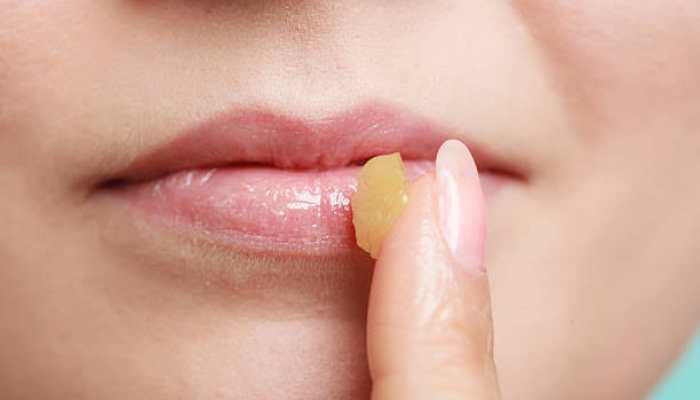 Top Lip Balms for Hydration, Protection, and a Touch of Luxury