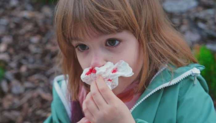 Why Do Kids Get More Nosebleeds In Summer? Causes And Solutions