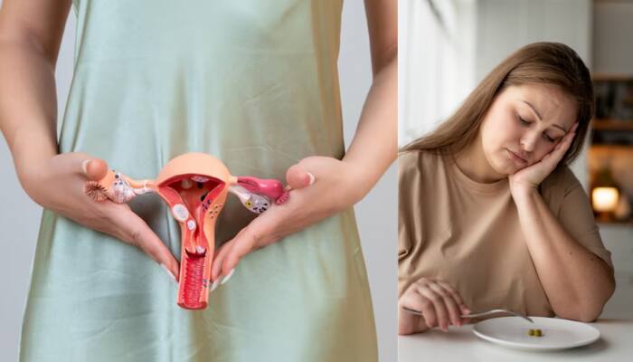 Endometriosis And Eating Disorders: How Chronic Illness Impacts Mental Health