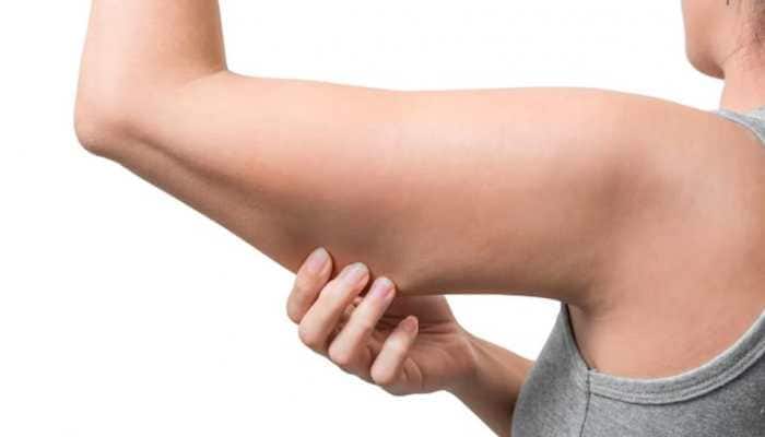 Say Goodbye To Flabby Arms: Try These 5 Simple Exercises For Quick Results