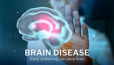 Scientists Develop Skin Test That Detects Rare Brain Disorder PSP With 90% Accuracy