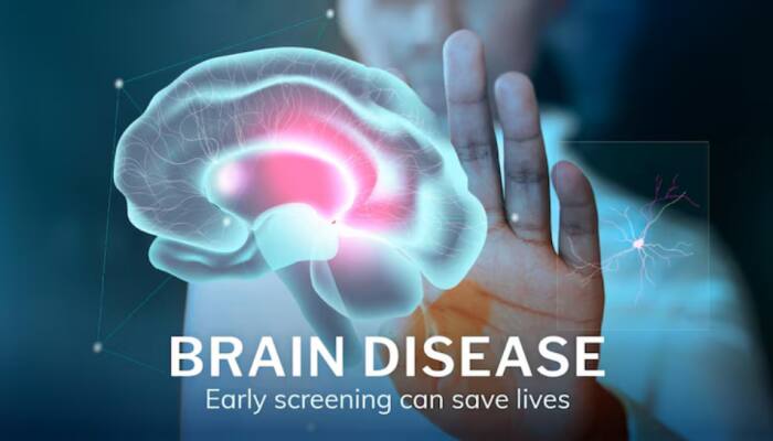 Scientists Develop Skin Test That Detects Rare Brain Disorder PSP With 90% Accuracy