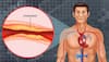 heart disease treatment