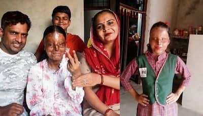 Meet Kafi: Hisar Acid Attack Survivor Who Scored 95.6% In CBSE Board Class 12th Result And Topped Chandigarh Blind School
