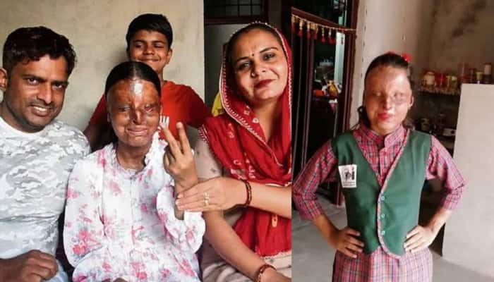 Meet Kafi: Hisar Acid Attack Survivor Who Scored 95.6% In CBSE Board Class 12th Result And Topped Chandigarh Blind School