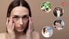 10 Effective Natural Remedies To Reduce Dark Circles Under Eyes At Home Fast