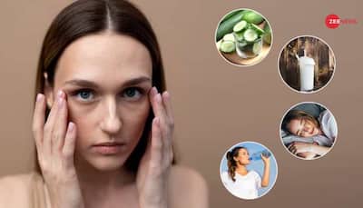 10 Effective Natural Remedies To Reduce Dark Circles Under Eyes At Home Fast