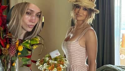 Jennifer Lopez Sustains Facial Injury During American Music Awards Rehearsals