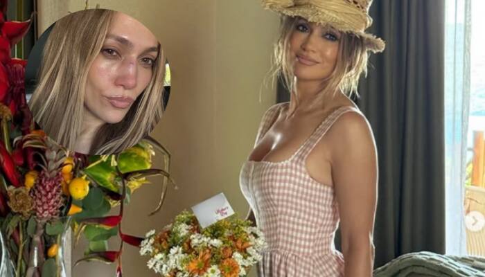 Jennifer Lopez Sustains Facial Injury During American Music Awards Rehearsals