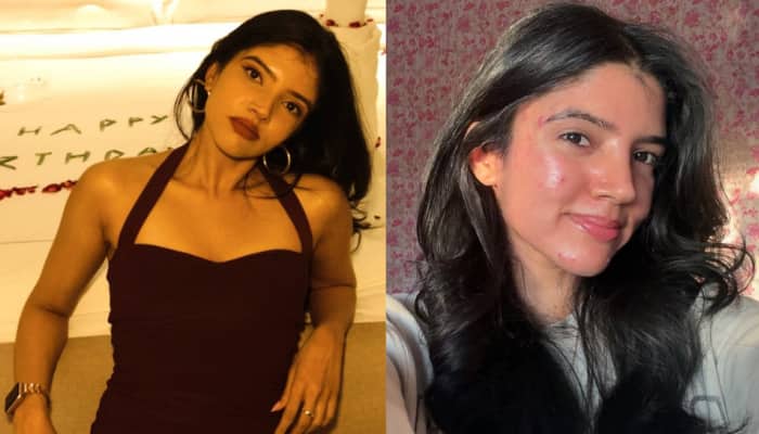 Expert Shares Skincare Routine That Helped Her Manage PCOS-Related Acne