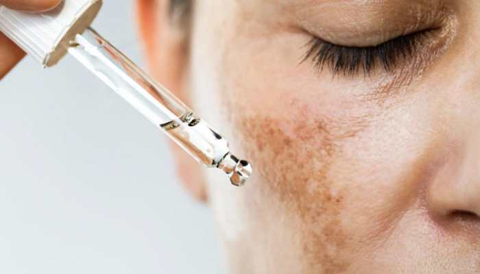 Reveal Brighter Skin: Your Morning Hyperpigmentation Routine