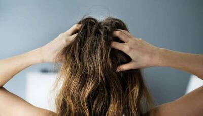 Unlock the Power of Hair Oils for Beautiful Hair