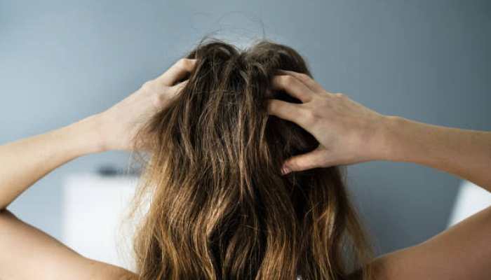 Unlock the Power of Hair Oils for Beautiful Hair Unlock the Power of Hair Oils for Beautiful Hair