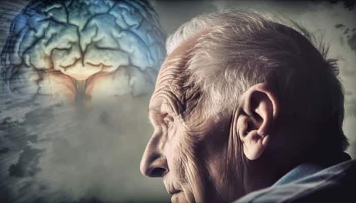 Study Finds Genetic Variant That Doubles Dementia Risk In Men: Read Here