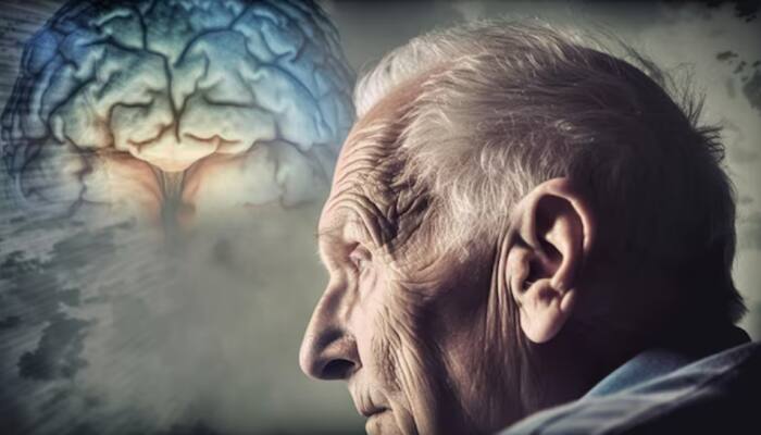 Study Finds Genetic Variant That Doubles Dementia Risk In Men: What You Need To Know