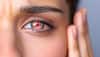 Eye health