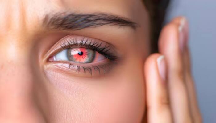Too Hot To Handle: How Rising Heatwaves Are Putting Your Eye Health At Risk And What You Can Do