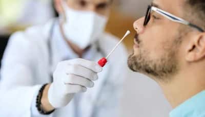 When Should A Patient With Mild Cold-Like Symptoms Consider Taking An RT-PCR Test For COVID 19?
