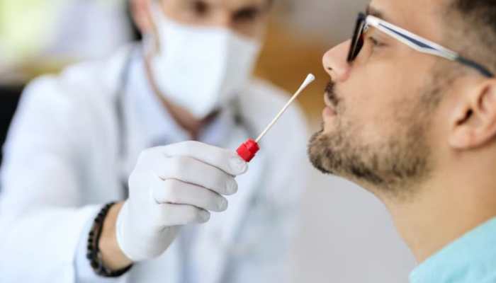 When Should A Patient With Mild Cold-Like Symptoms Consider Taking An RT-PCR Test For COVID 19? When Should A Patient With Mild Cold-Like Symptoms Consider Taking An RT-PCR Test For COVID 19?