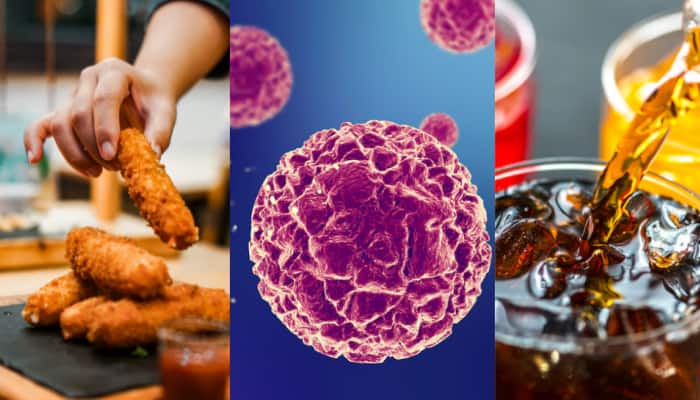 Harvard Doctor Lists 6 Common Foods That May Raise Cancer Risk — Check Healthi