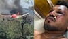 Ahmedabad Plane Crash: Miracle On Seat 11A; Passenger Survives Fatal Crash With Minor Injuries