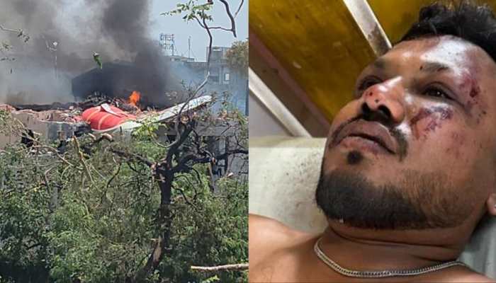 Ahmedabad Plane Crash: Miracle On Seat 11A; Passenger Survives Fatal Crash With Minor Injuries Ahmedabad Plane Crash: Miracle On Seat 11A; Passenger Survives Fatal Crash With Minor Injuries