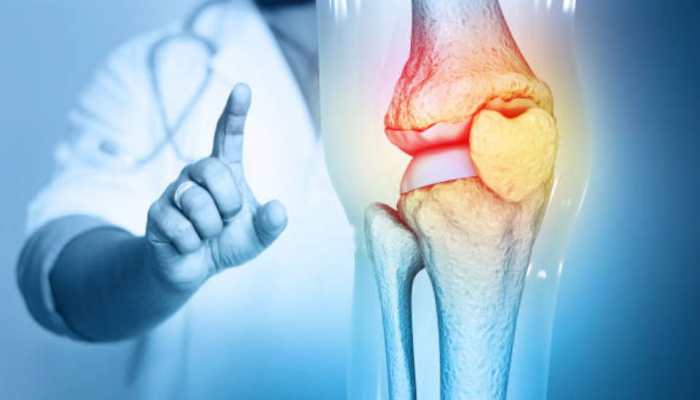 5 Ways One Should Take Precautions To Have Stronger Bones