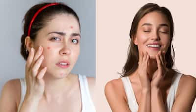 From Breakouts To Glow: A 3-Month Skincare Plan That Transform Your Skin Naturally