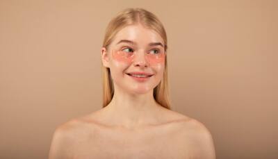 Say Goodbye To Puffy Eyes With These Quick And Easy Homemade DIY Eye Masks