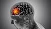 Potential Of Stem Cell Therapy In Brain Tumour Treatment