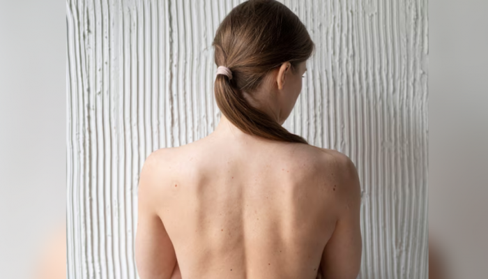 How To Treat Back Acne: 8 Simple And Effective Skincare Hacks You Can Try At Home How To Treat Back Acne: 8 Simple And Effective Skincare Hacks You Can Try At Home