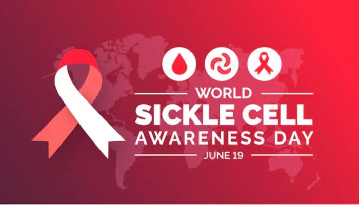 World Sickle Cell Awareness Day 2025: Date, Theme, History, Significance Everything You Need To Know