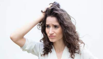 Top 7 Simple Home Remedies To Control Greasy Hair Naturally During The Summer Season